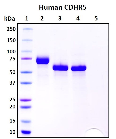 SDS-PAGE