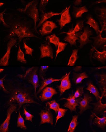 Immunofluorescence - ENO2 antibody (144-012341)