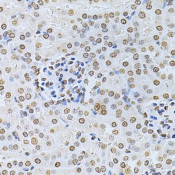 Immunohistochemistry - ILK Polyclonal Antibody (144-00901)