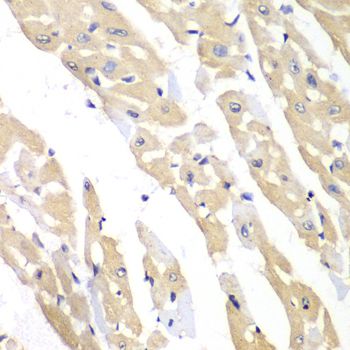 Immunohistochemistry - CCT3 antibody (144-06547)
