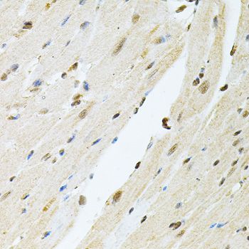 Immunohistochemistry - PNKP antibody (144-06693)