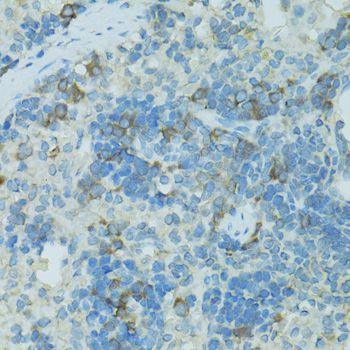 Immunohistochemistry - TJP2 Polyclonal Antibody (144-00594)