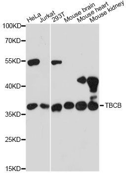 Western blot - TBCB antibody (144-60252)