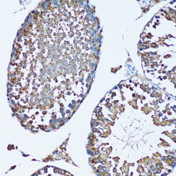 Immunohistochemistry - FDFT1 antibody (144-06229)