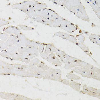 Immunohistochemistry - [KO Validated] BAZ1B Polyclonal Antibody (144-09851)