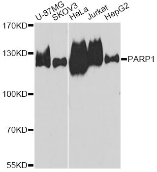 Western blot - PARP1 Polyclonal Antibody (144-00942)