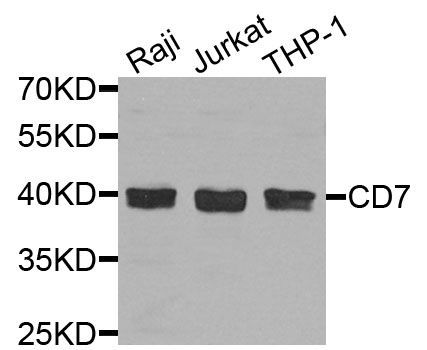 Western blot - CD7 antibody (144-07650)
