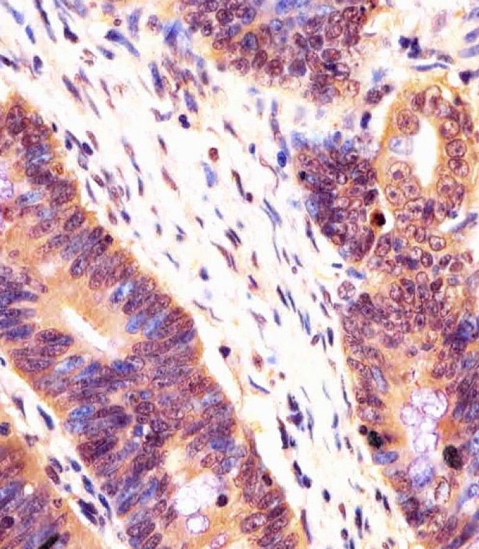 IHC-P