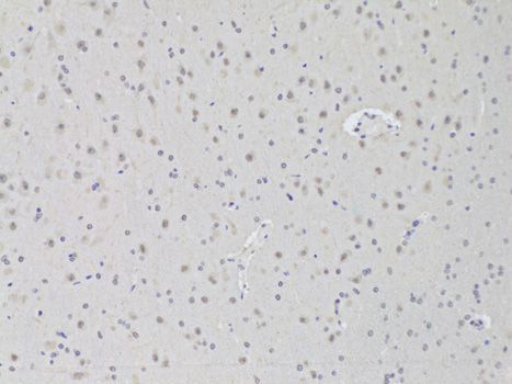 Immunohistochemistry - AAAS Antibody (144-06427)