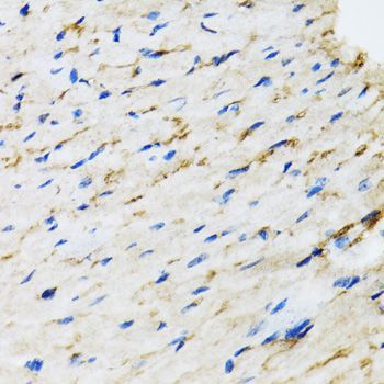 Immunohistochemistry - RAF1 Polyclonal Antibody (144-00223)
