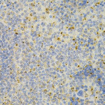 Immunohistochemistry - PSAP Antibody (144-01819)