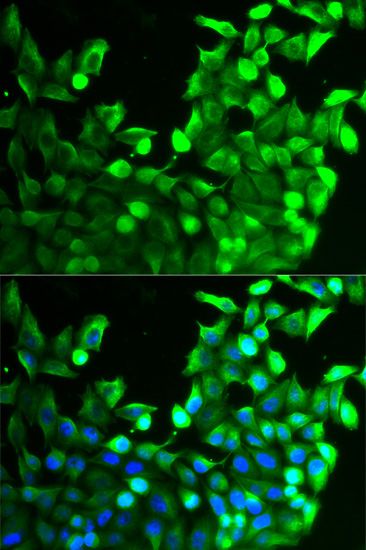 Immunofluorescence - FGFR2 antibody (144-02074)