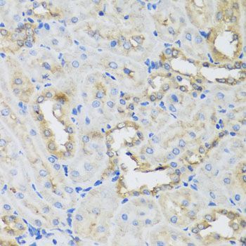Immunohistochemistry - AHCYL1 antibody (144-07773)