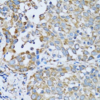 Immunohistochemistry - RARS antibody (144-06307)