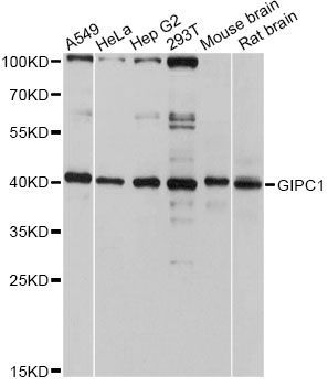 Western blot - GIPC1 Polyclonal Antibody (144-10550)