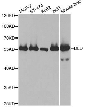 Western blot - DLD antibody (144-60270)