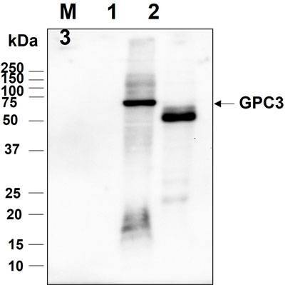Western blot