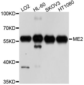 Western blot - ME2 antibody (144-09650)
