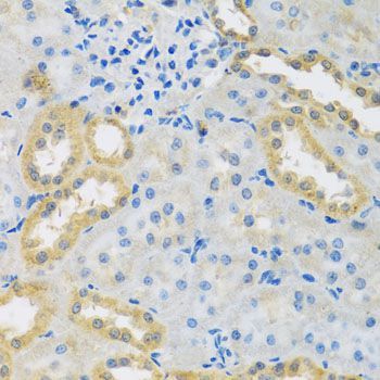 Immunohistochemistry - PMPCB antibody (144-04312)