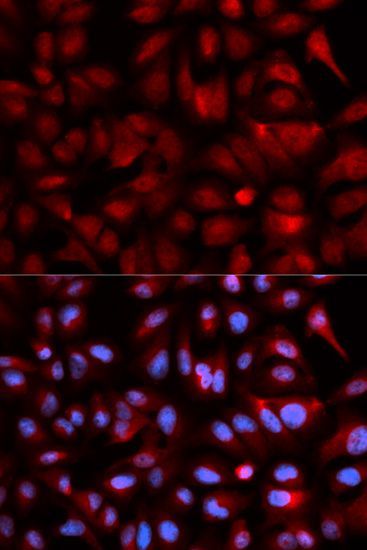 Immunofluorescence - PSMB5 Polyclonal Antibody (144-01975)