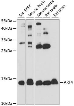 Western blot - ARF4 Polyclonal Antibody (144-61451)