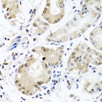 Immunohistochemistry - PCBP1 Polyclonal Antibody (144-01044)