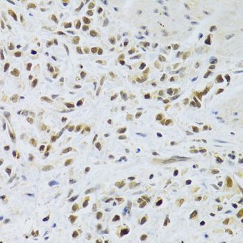 Immunohistochemistry - RAD50 Polyclonal Antibody (144-60013)