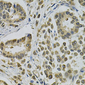 Immunohistochemistry - EBAG9 Antibody (144-01935)