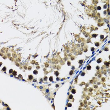 Immunohistochemistry - DDX41 Polyclonal Antibody (144-06576)