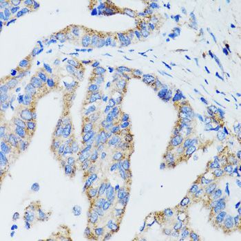 Immunohistochemistry - USO1 Polyclonal Antibody (144-02796)
