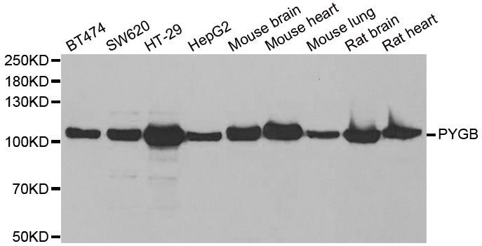 Western blot - PYGB Polyclonal Antibody (144-06402)