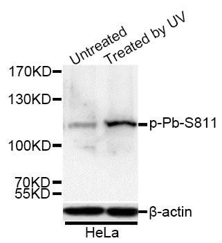 Western blot - Phospho-Rb-S811 antibody (144-50089)