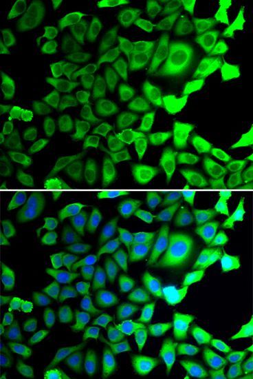 Immunofluorescence - USP8 Polyclonal Antibody (144-07031)