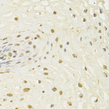 Immunohistochemistry - HDAC3 Polyclonal Antibody (144-02139)