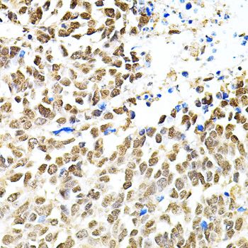 Immunohistochemistry - PNKP antibody (144-06693)