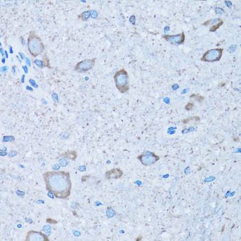 Immunohistochemistry - NNMT antibody (144-06673)