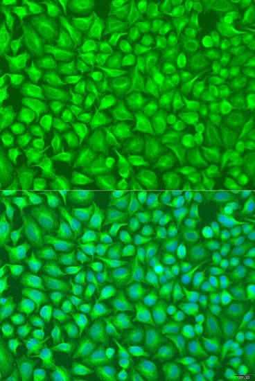 Immunofluorescence - GFM1 Polyclonal Antibody (144-05077)
