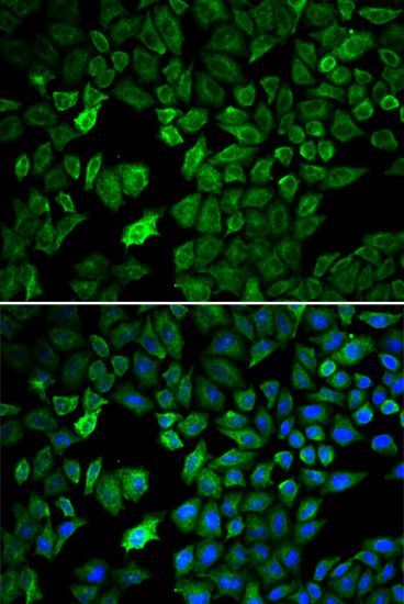 Immunofluorescence - PRMT5 antibody (144-01520)