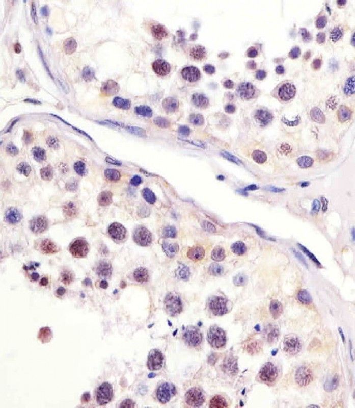 IHC-P