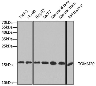 Western blot - TOMM20 antibody (144-06774)
