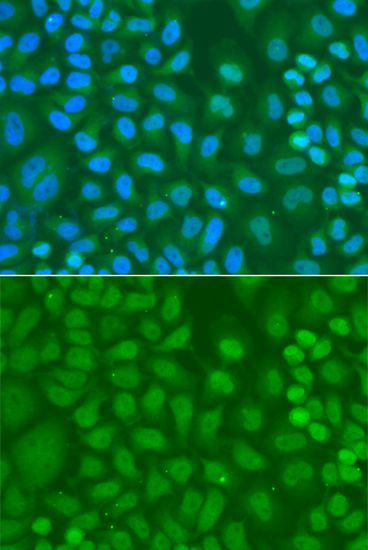 Immunofluorescence - CXXC1 Polyclonal Antibody (144-013423)