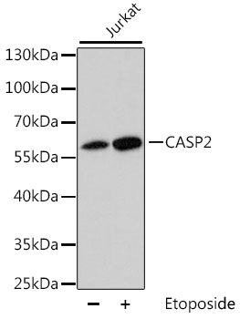 Western blot - CASP2 antibody (144-05724)