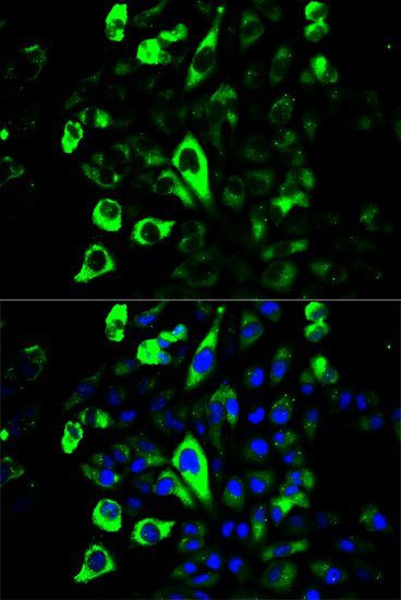 Immunofluorescence - GZMB antibody (144-02557)