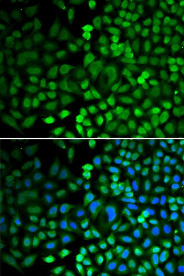 Immunofluorescence - APEX1 antibody (144-01117)