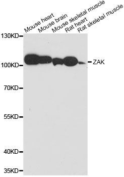 Western blot - ZAK antibody (144-014513)