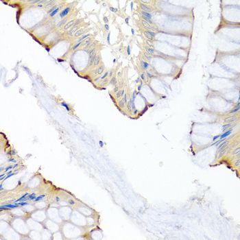 Immunohistochemistry - LRG1 antibody (144-07850)