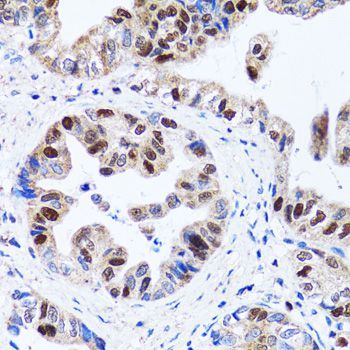 Immunohistochemistry - UHRF1 antibody (144-02343)