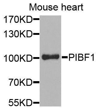 Western blot - PIBF1 antibody (144-03072)