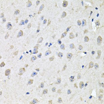 Western blot - CHCHD3 Polyclonal Antibody (144-08584)