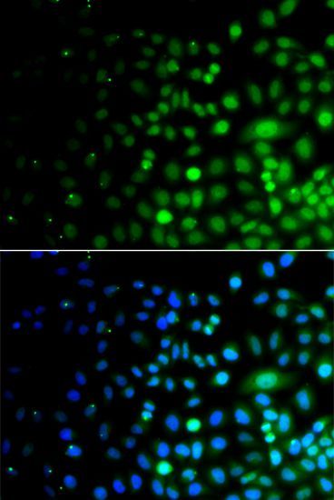 Immunofluorescence - UBA6 Polyclonal Antibody (144-07511)